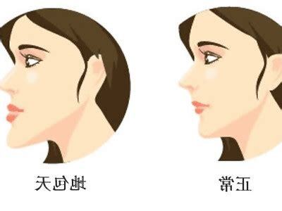 地包天 意思
